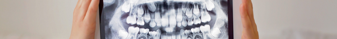 Personal injury legal training header